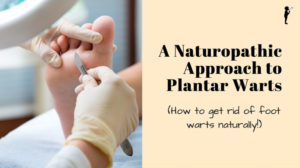 Natural approach to getting rid of plantar warts!
