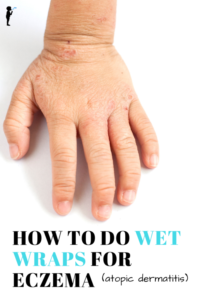 How to do wet wraps for #eczema