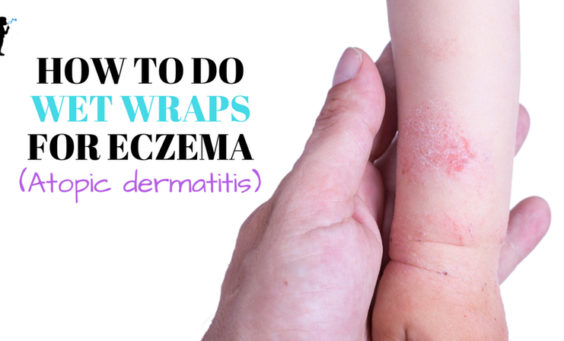 How to do wet wraps for eczema. #Naturopathic #Pediatrics