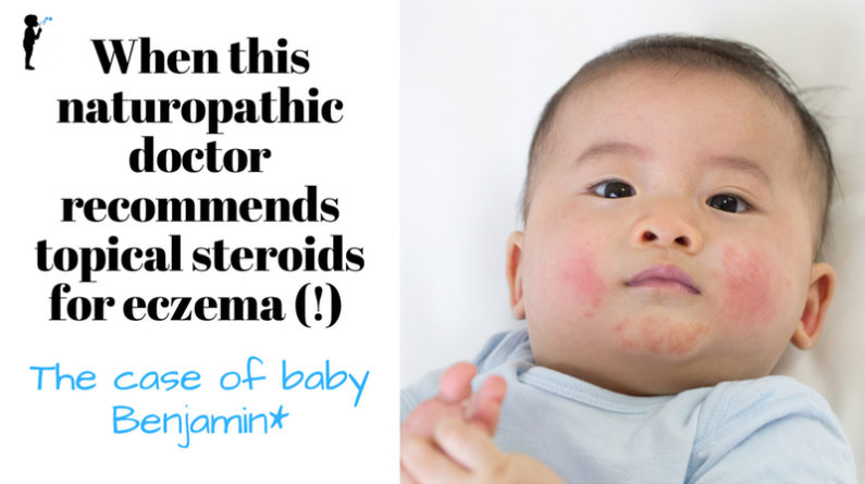 When this naturopathic doctor recommends topical steroids for eczema! - The case of baby Benjamin*