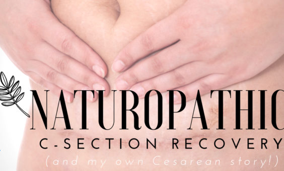Naturopathic c-section recovery (and my own cesarean story!) #Naturopathic