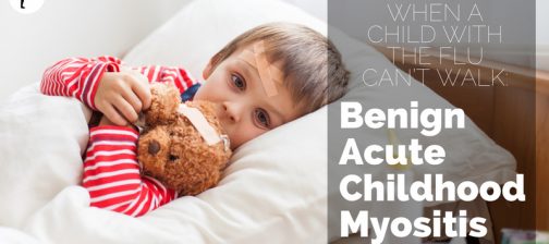 When a child with the flu can't walk: Benign Acute Childhood Myositis. From #Naturopathic Pediatrics